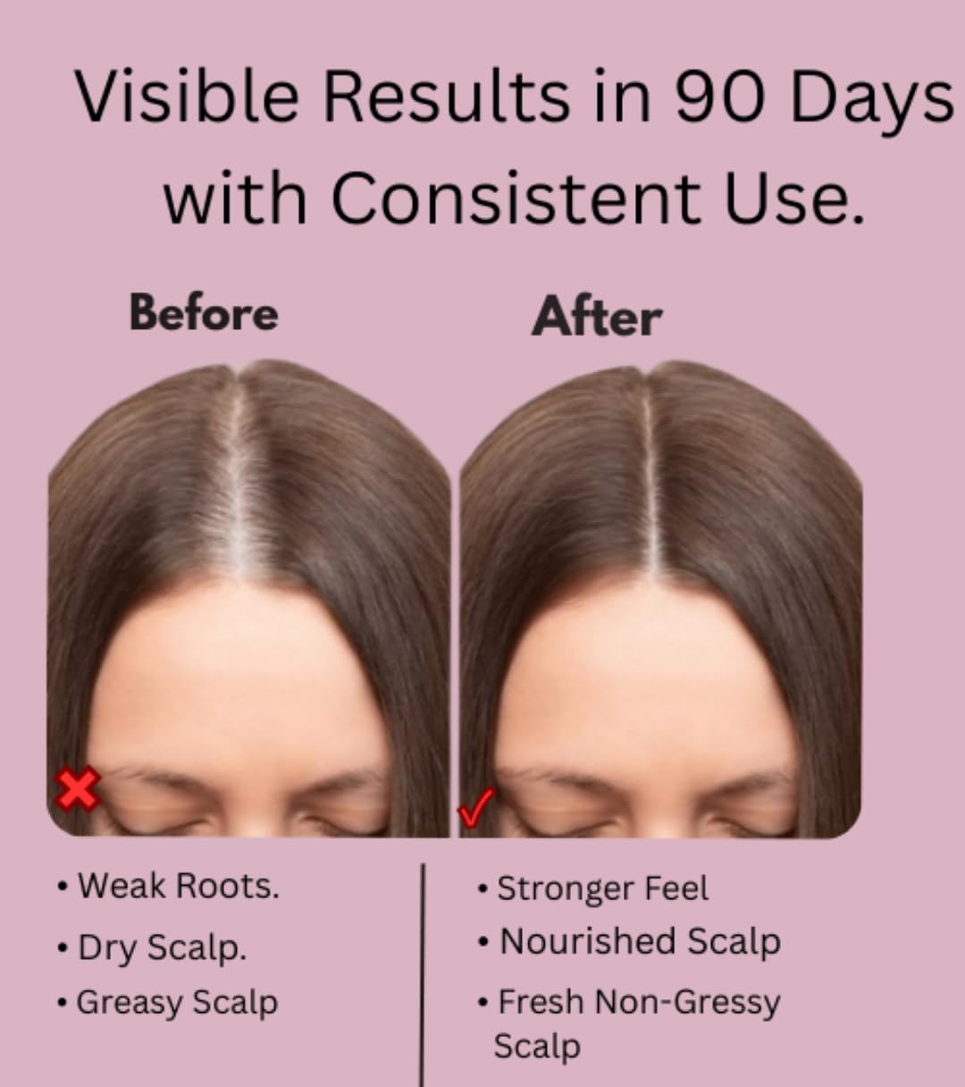 Electric Scalp Massage Comb with Red Light Therapy